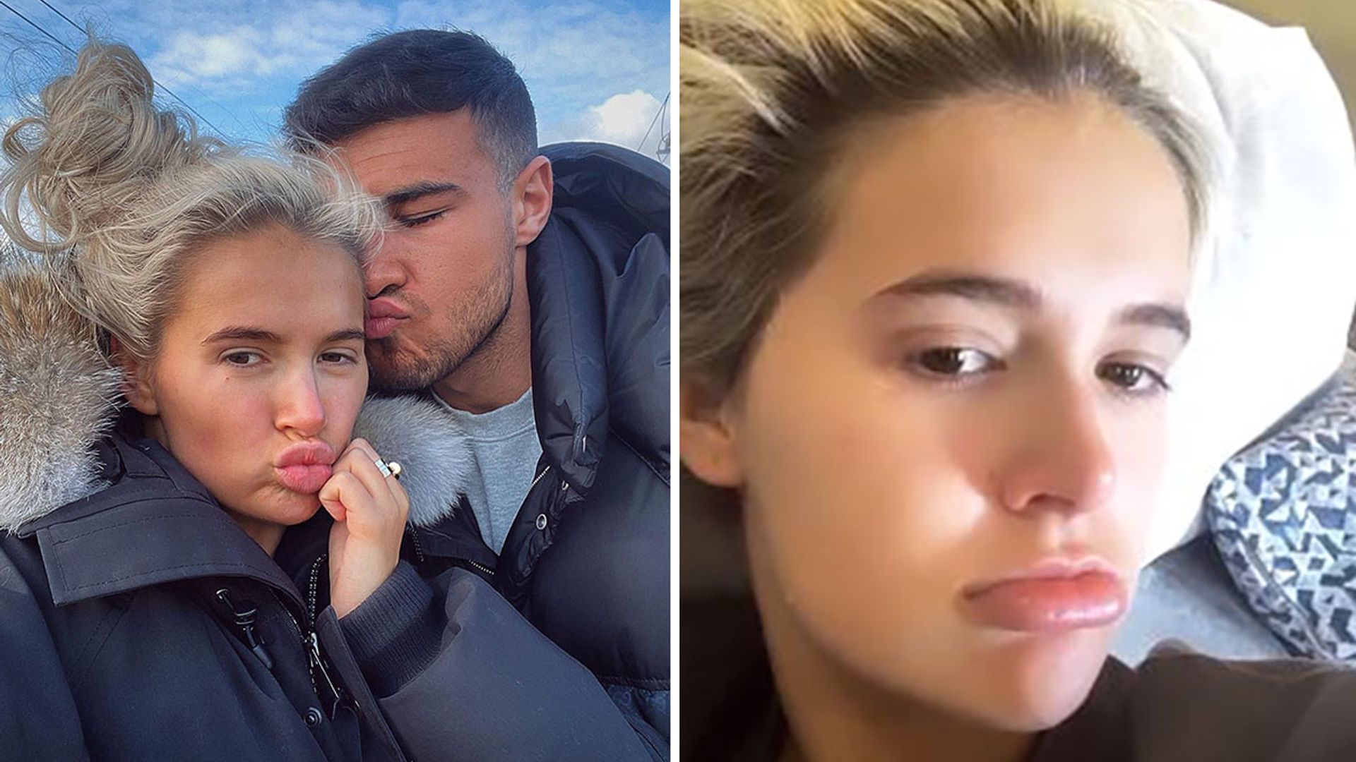 Love Island star Molly Mae Hague in agony after boyfriend Tommy Fury
