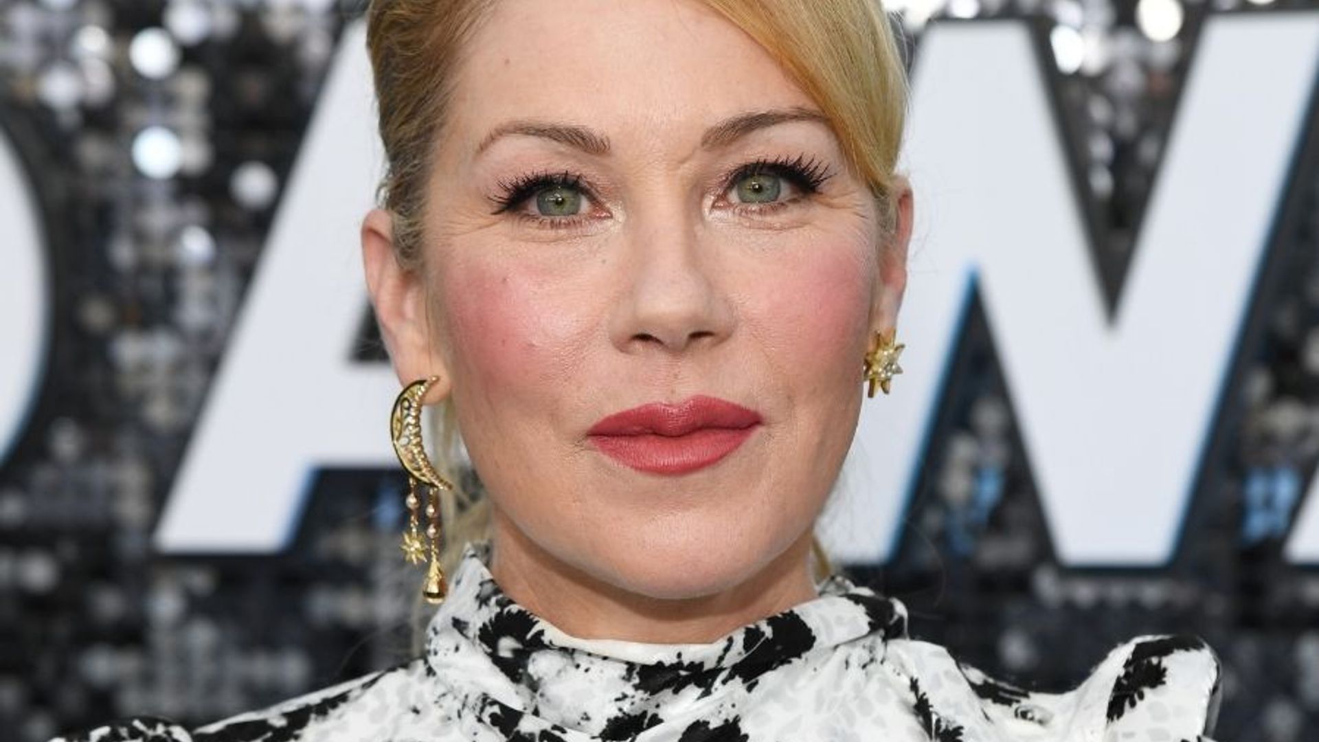 Christina Applegate Reveals She Was Diagnosed With Multiple Sclerosis A Few Months Ago Hello