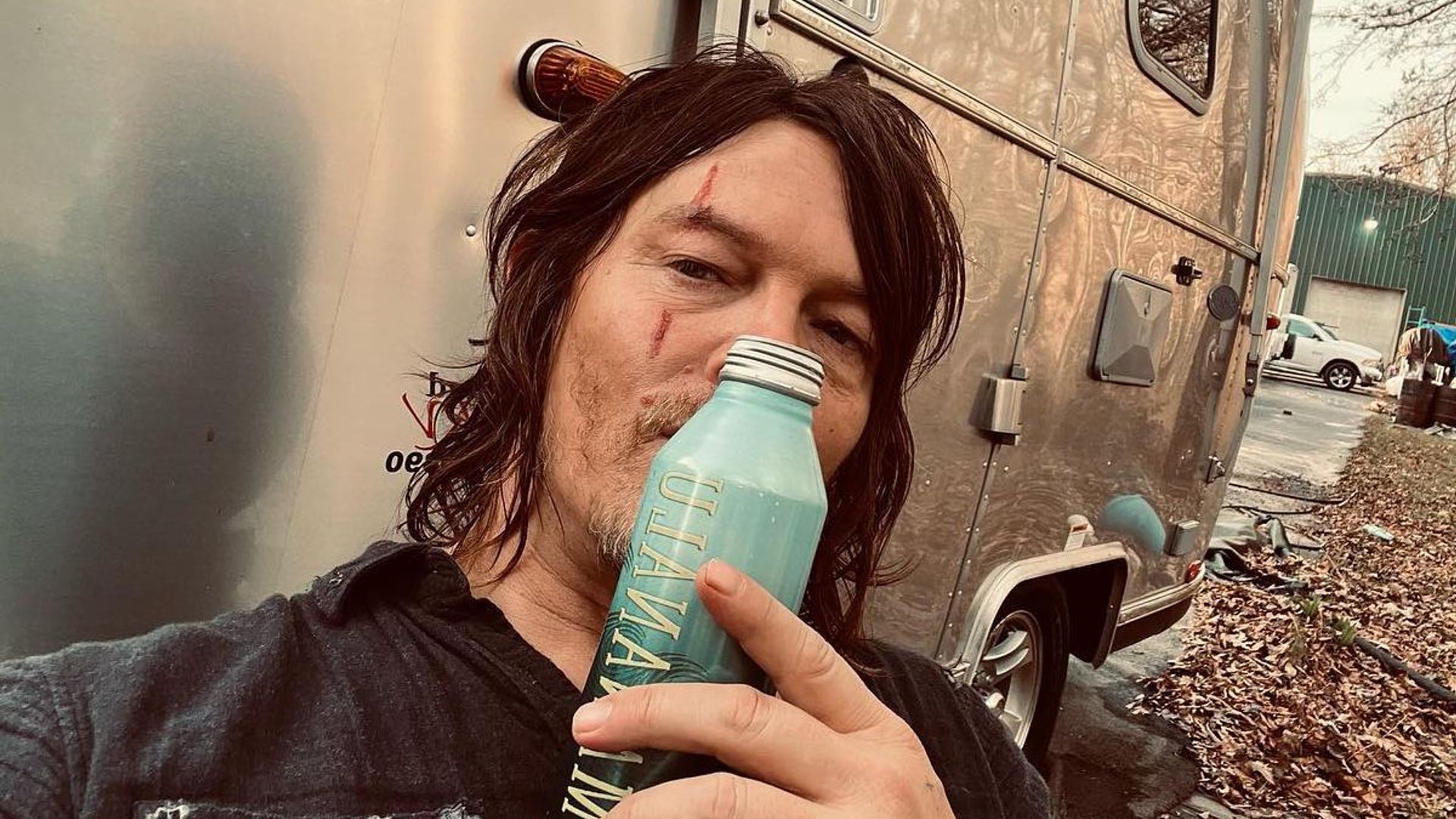 Norman Reeds Suffers Head Injury While Filming The Walking Dead Hello