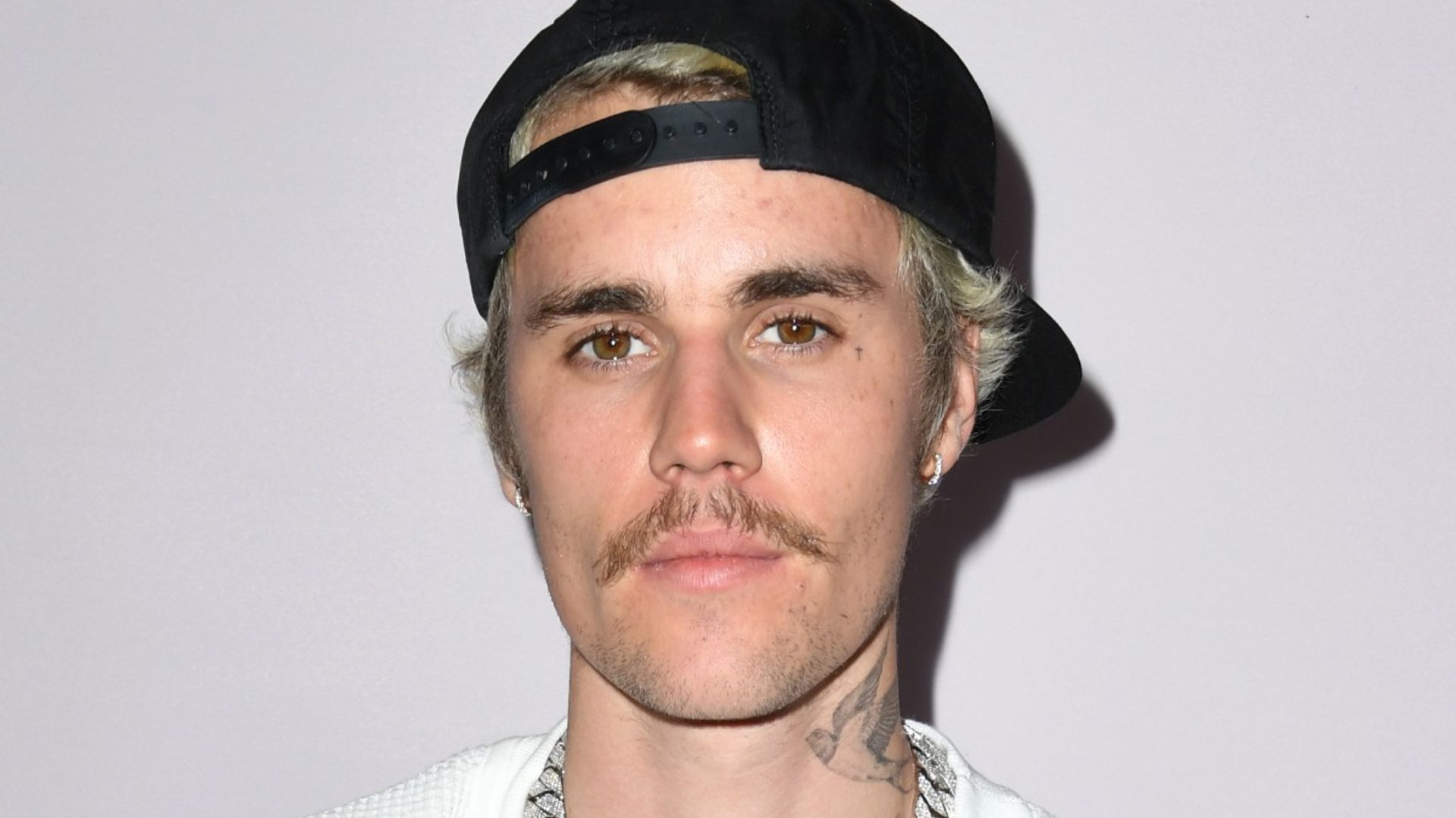 Justin Bieber Shares Shocking Health Update With Fans After Canceling Tour Hello