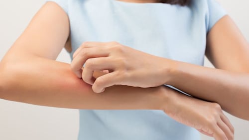 7 dermatologist tips for managing eczema