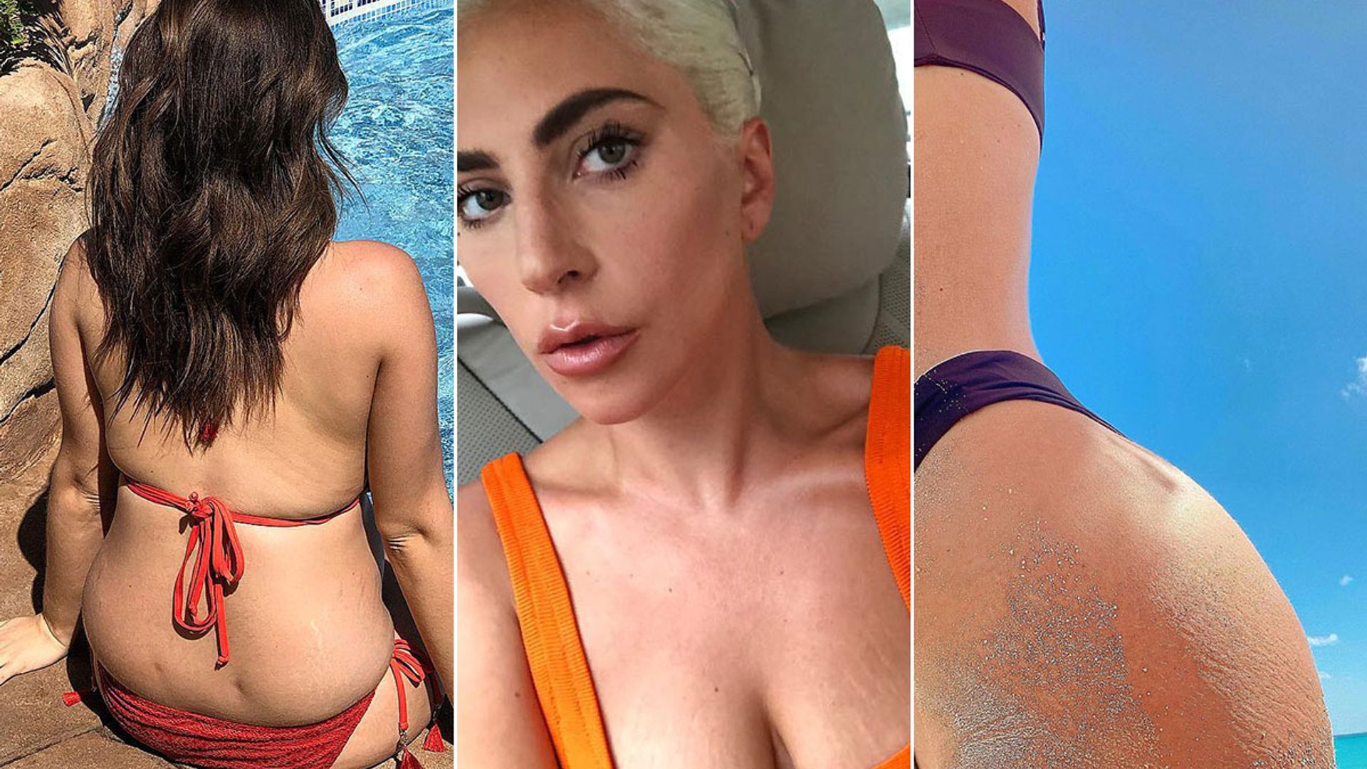 Celebs stretch mark photos Stacey Solomon, Chrissy Teigen, Kylie Jenner, more HELLO!