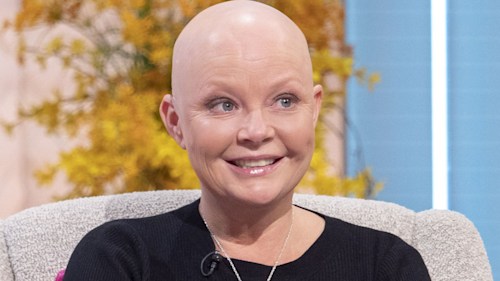 Gail Porter shares health update following fractured skull