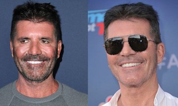 Simon Cowell's teeth before and after: What has BGT star done to his ...