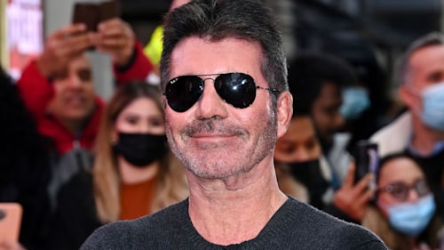 What happened to Simon Cowell's teeth? Before and after explained