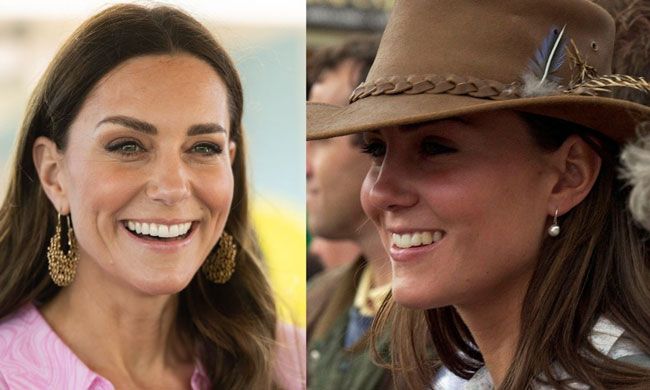 Fremme Whitney kompression Kate Middleton teeth: what has Princess of Wales done to her smile? | HELLO!