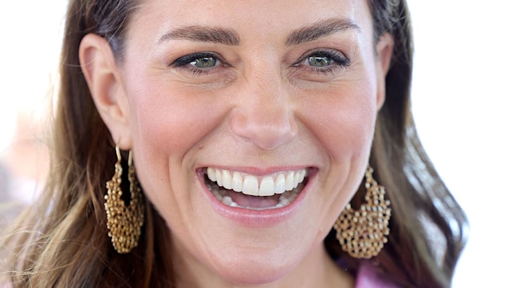 The Chelsea Dental Clinic's leading dentist, Dr. Rhona Eskander, claims that Kate's smile's flaws really add to its beauty.
