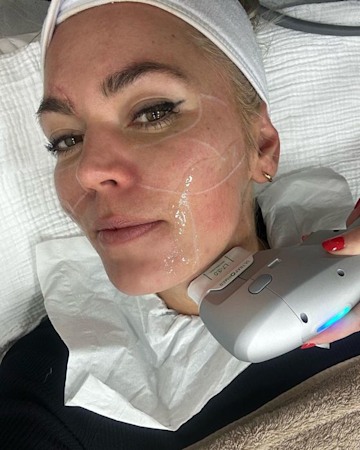 Danni Menzies lying on a facialist bed with her eyebrow scar showing
