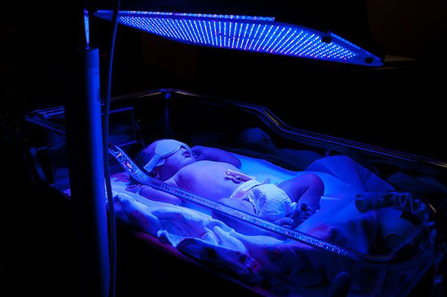 bilirubin light box