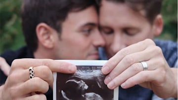 Tom Daley and Dustin Lance Black's ultrasound photo