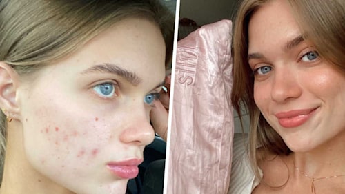 This anti-acne silk pillowcase will change your life and it's all over TikTok right now