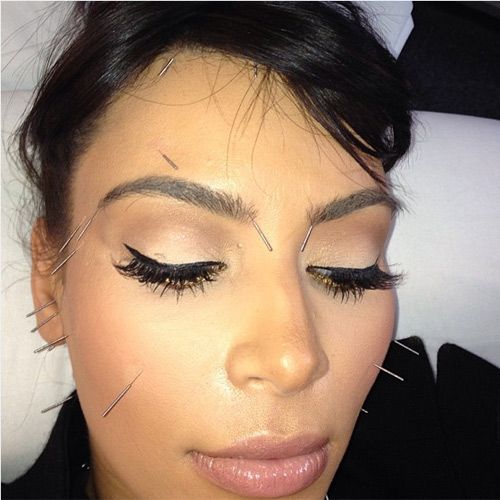 Kim Kardashian relaxes with an acupuncture facial HELLO!