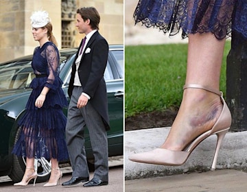 TrivDaily - 17 times the royals have sported injuries 55 princess-beatrice-bruised-ankle