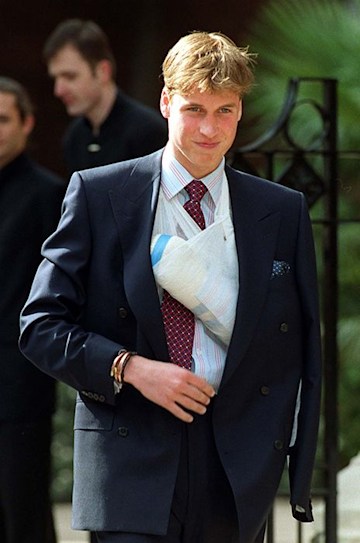 TrivDaily - 17 times the royals have sported injuries 56 prince-william-arm-injury