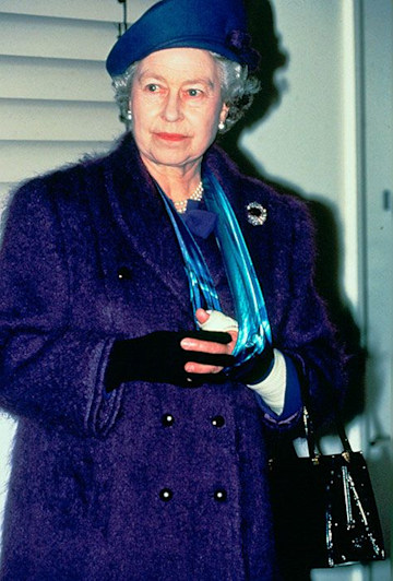 TrivDaily - 17 times the royals have sported injuries 64 the-queen-arm-cast